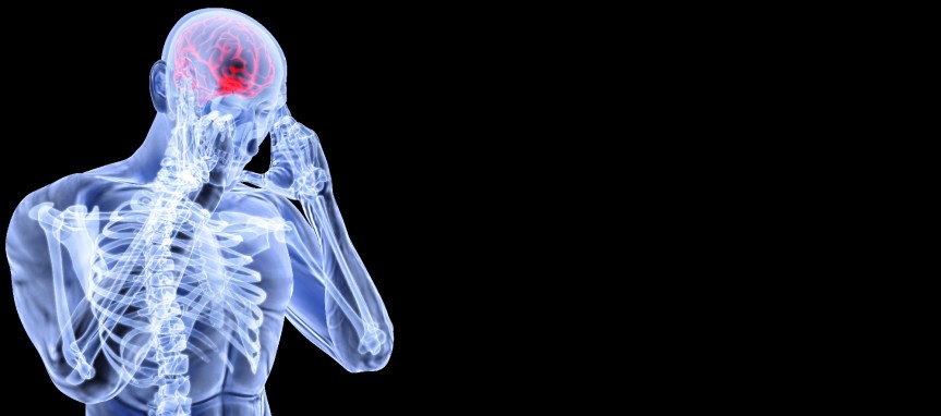 brain-SPECT-scan-florida