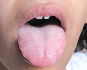 White-Tongue-Pictures-3